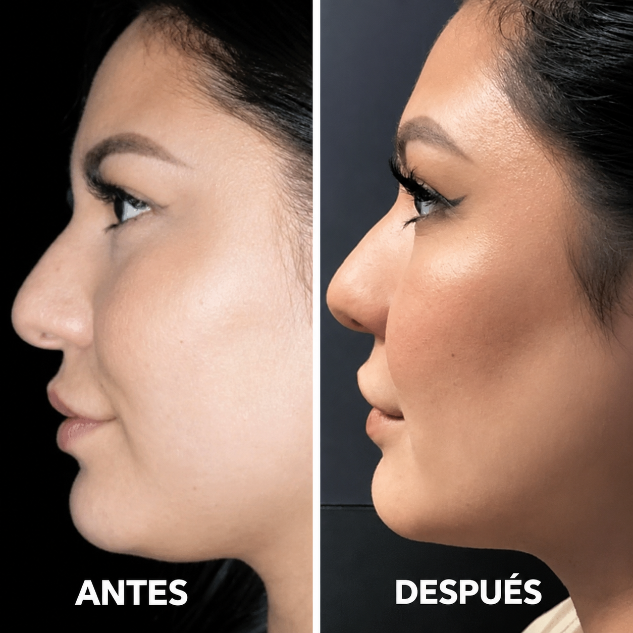 Reductor de Papada NÍTEA — Tonifica 60 Músculos Faciales en 15 Minutos